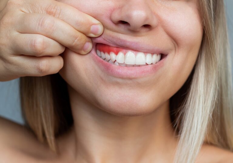 تاثیر بیماری لثه بر عملکرد مغز